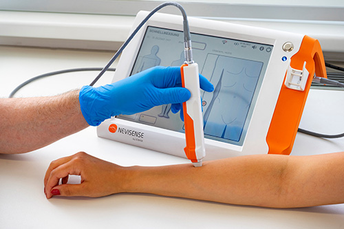 Hautuntersuchung mittels Nevisense ® Sensor am Arm einer Patentin